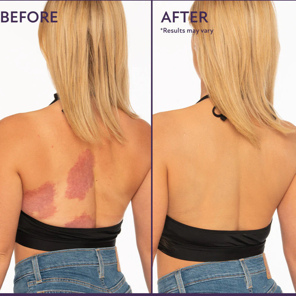 Body Coverage Perfector